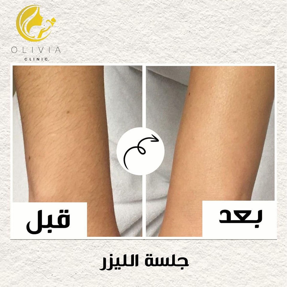 olivia clinic port said - عيادات جلدية في بورسعيد