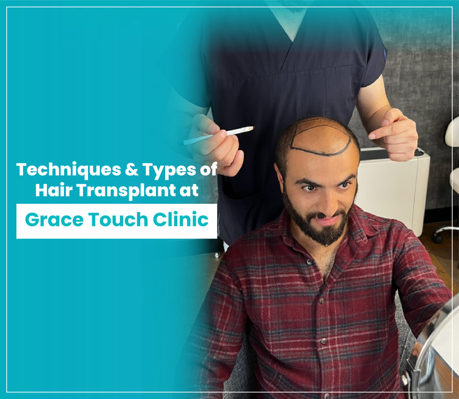 SF touch clinic - زراعة الشعر في دمياط