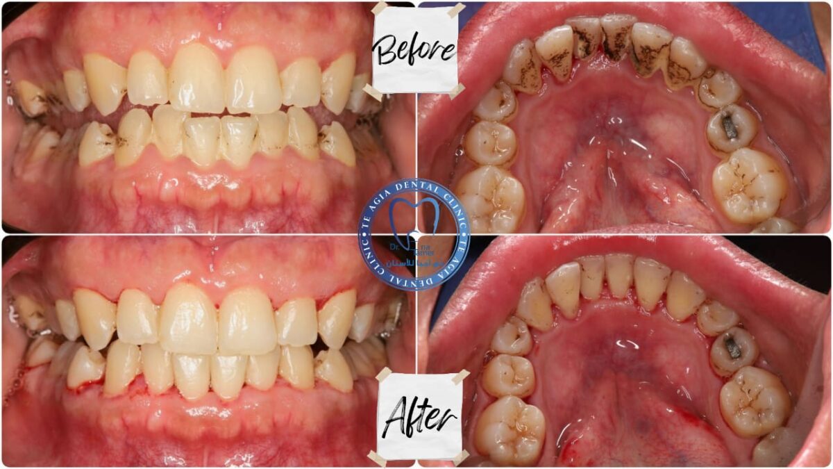 Te Agia Dental Clinic - عيادات أسنان في المنصورة
