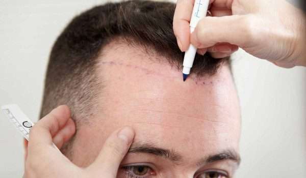 تقاطع الوائلي - زراعة الشعر في ذي قار