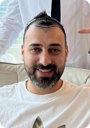 زراعة الشعر في تركيا | MASTERING HAIR | ماسترينغ هير - زراعة الشعر في الوسطى