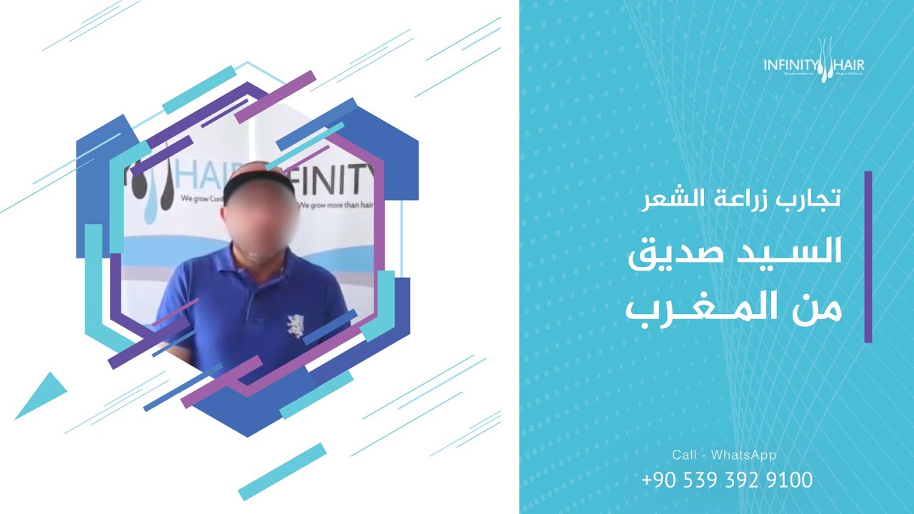 زراعة الشعر في تركيا . مركز Infinity Hair لـ زراعة الشعر اسطنبول - زراعة الشعر في الغربية